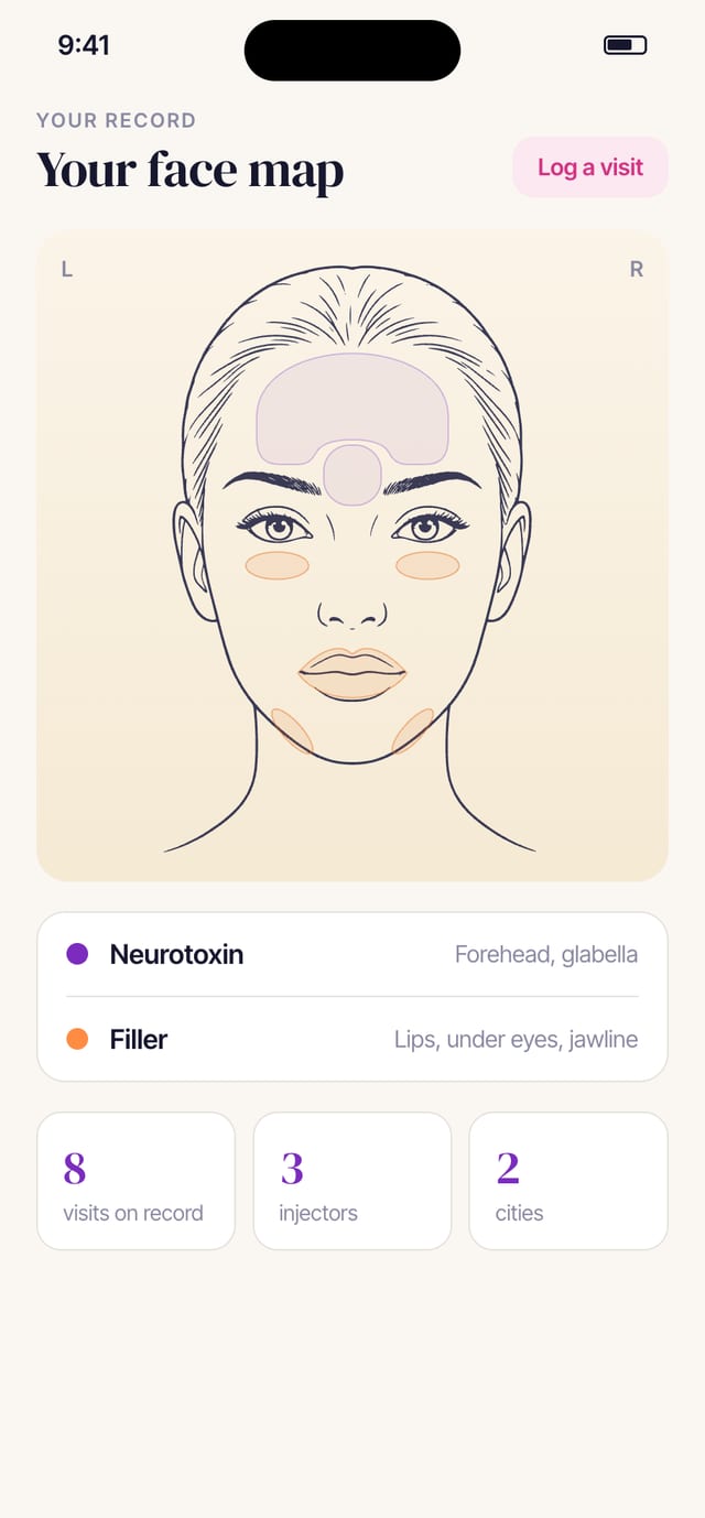 The Rinnova face map with shaded areas for Botox and filler, and a legend by area