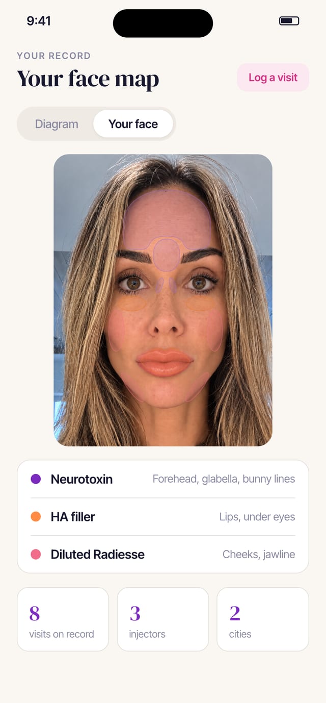 The Rinnova face map on the patient’s own photo, with each treated area shaded and a legend by product